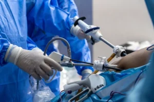 Surgery for Workers Comp