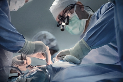 Does Surgery Increase Workers Comp Settlement?